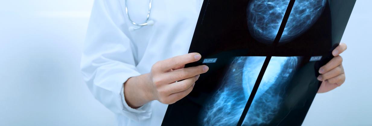 Healthcare worker holding an xray